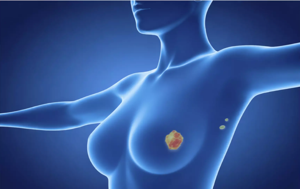 Camera placed on patient body